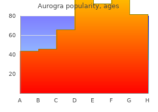 generic aurogra 100mg fast delivery