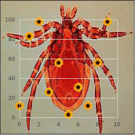 Gonadal dysgenesis, XY female type