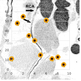 Hyperimmunoglobinemia D with recurrent fever