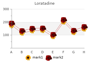 loratadine 10 mg with visa