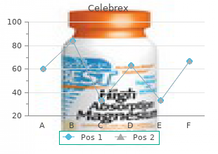 generic celebrex 200 mg with visa