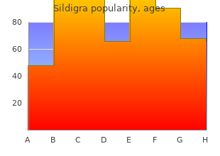 order sildigra 50 mg with visa