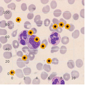 Pancreatic islet cell tumors