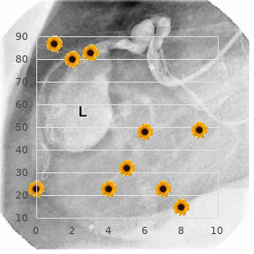 Chromosome 8, partial trisomy