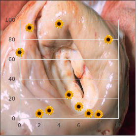 Choroid plexus neoplasms